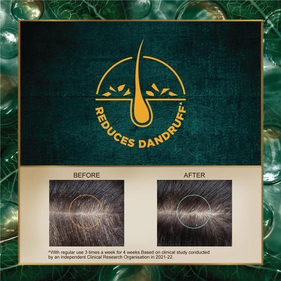 Indulekha Anti Dandruff Shampoo 650 Ml|| for Dandruff Control|| With Pudina| Amla|| Rosemary OIl - Paraben Free|| For Men & Women