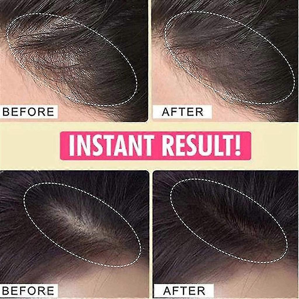 Hairline Powder Instantly Hair Line Shadow Quick Cover Hair Root Concealer Pen For Unisex Thinning Hair