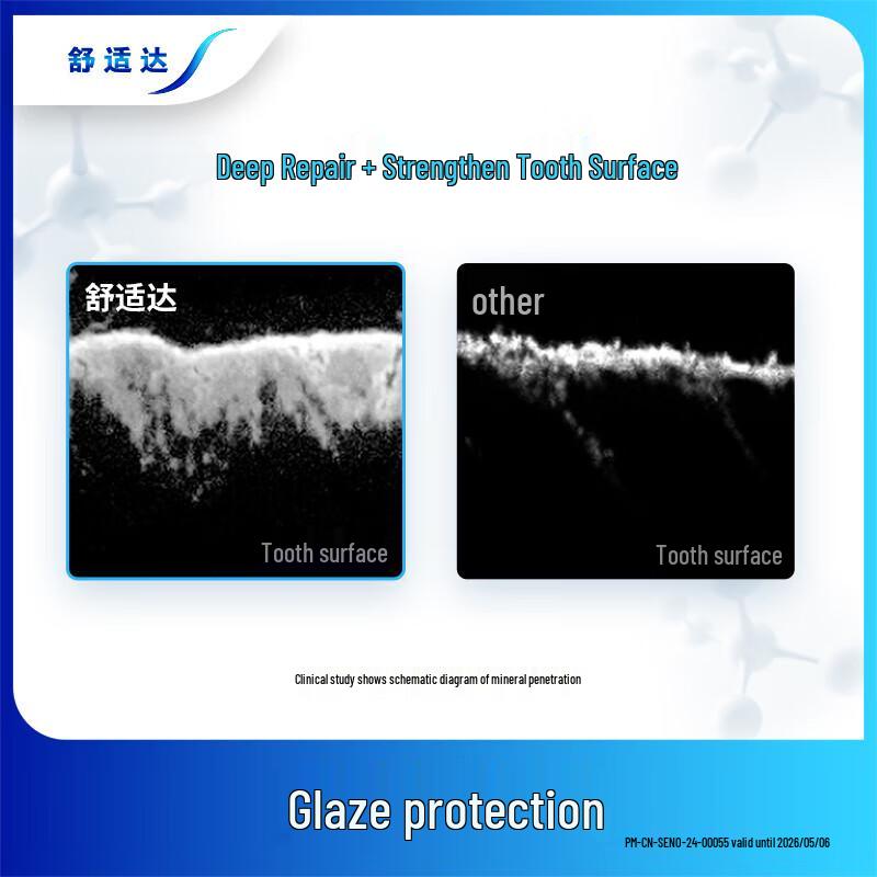 Sensodyne Rapid Relief Anti-Sensitivity Toothpaste