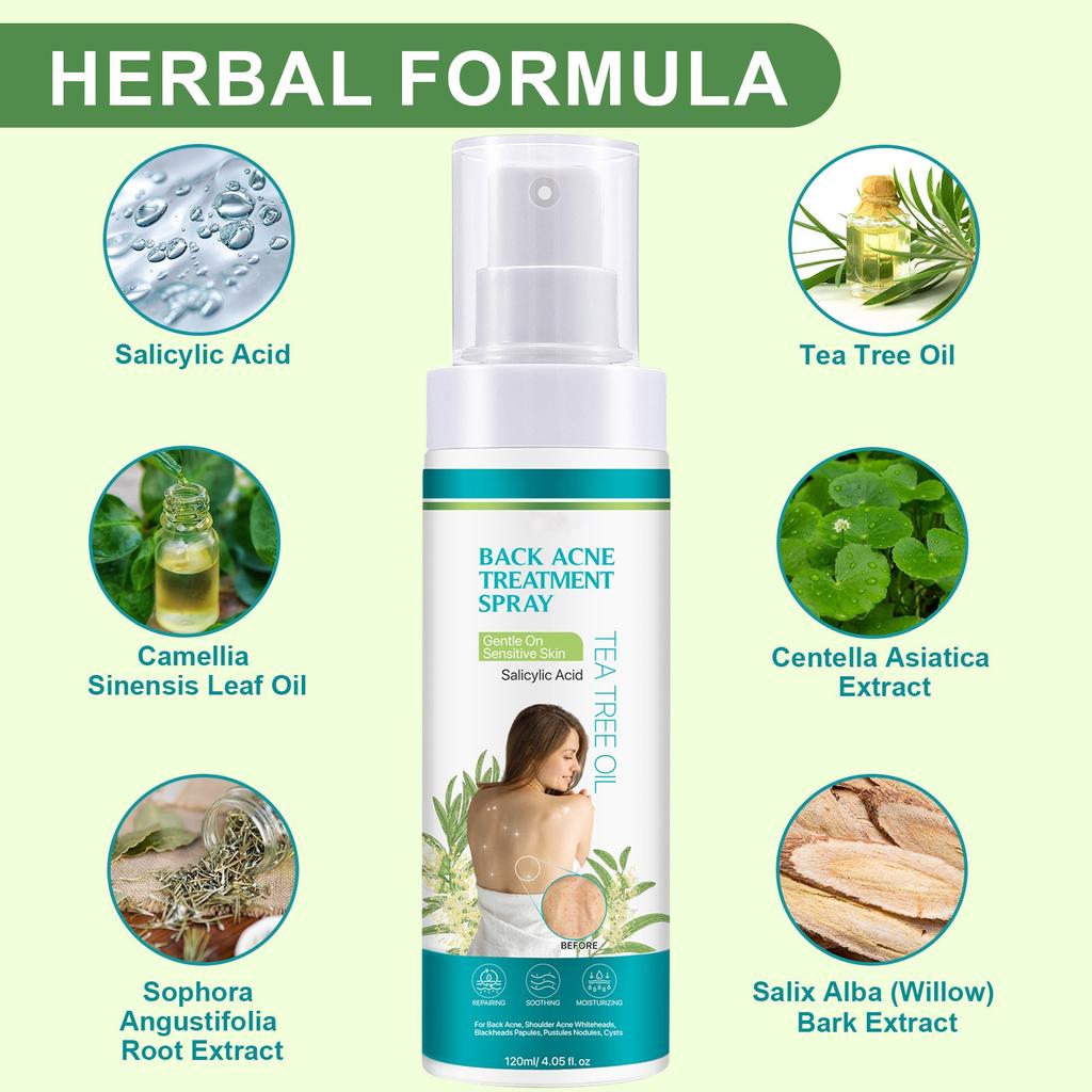 Back Acne Spray With Acne-removing Ingredients, Natural Back Acne Spray To Clear Back And Body Acne,120ML