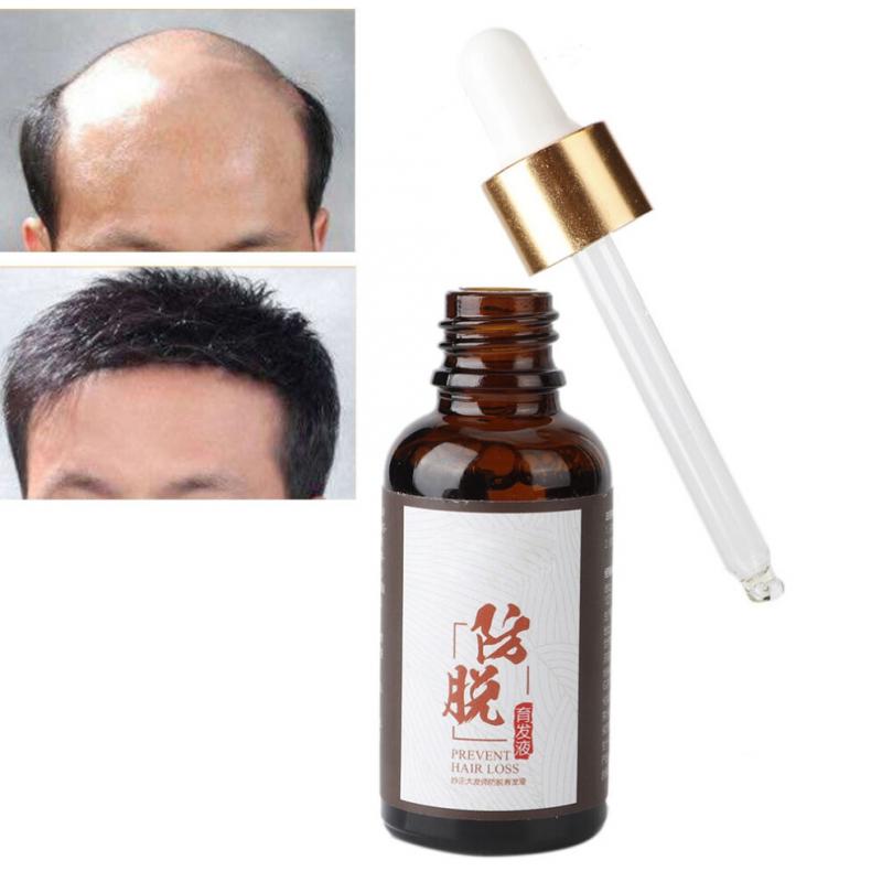 Daily scalp care, a fast-acting formula to promote hair growth, balances oil secretion, use 2-3 times daily 2pcs