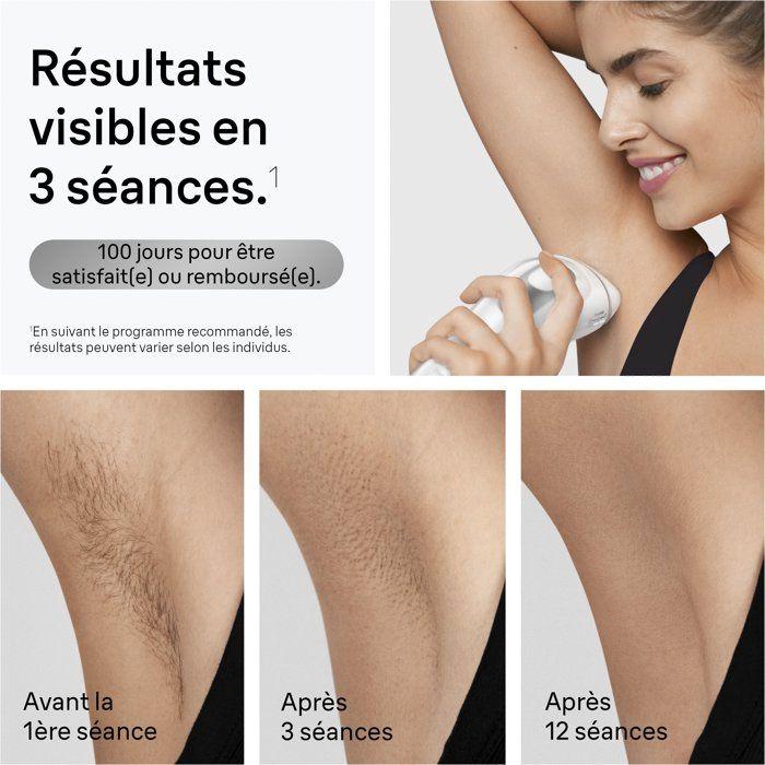 Pulsed light epilator - BRAUN - IPL PL3020 - 300,000 flashes - White