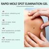 ג'ל להסרת כתמי שומות באופן מיידי, קרם מתקן לכל סוגי העור, תמציות טבעיות 50 גרם, ג'ל לחות, מסיר כתמים כהים לתיקון עור הגוף, מפחית