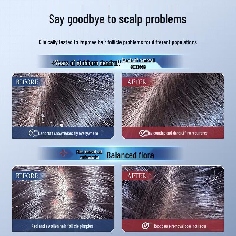 Vetes Selenium Disulfide Anti-Dandruff Shampoo