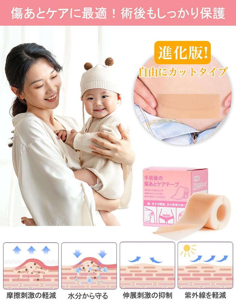 Narbenpflegetape für Kaiserschnitt Keloid Hypoallergen und Sanft zur für Narbe Silikon Anpassbar x Dermatologenempfohlen Narben,