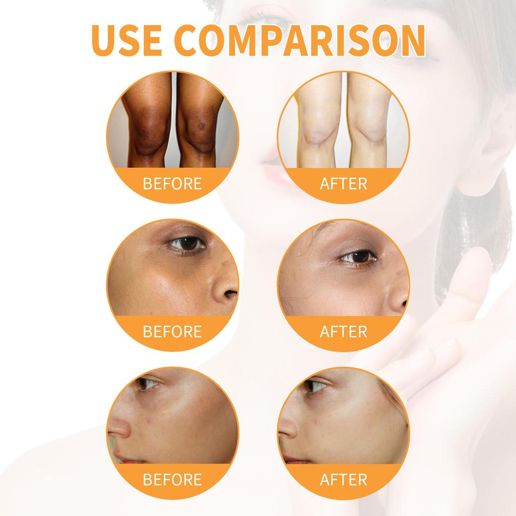 West&Month Papájový exfoliační gel - Jemně čistí keratin, hydratuje, zpevňuje a rozjasňuje pleť. Vhodné pro obličej a krk 100 ml