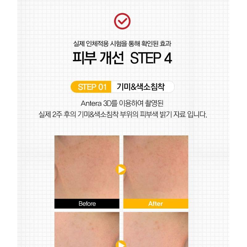 TOSOWOONG - 8 Days Spot Cream