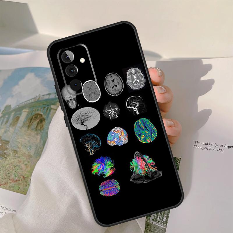 Medical Human Organs Brain Case For Samsung Galaxy A54 A34 A14 A06 A16 A26 A36 A56 A12 A32 A52 A13 A33 A53 A15 A35 A55