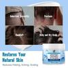 1/2/3x Scalp Soothing Cream - Nourishing Care, Reduces Dandruff & Itch Relief 100ml