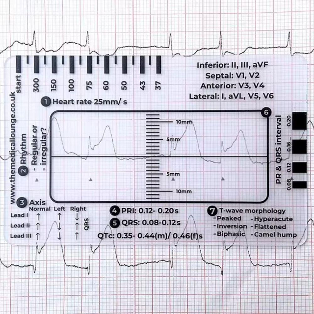 Průvodce interpretací EKG/EKG Přenosné kapesní pravítko pro interpretaci EKG pro hodnocení EKG