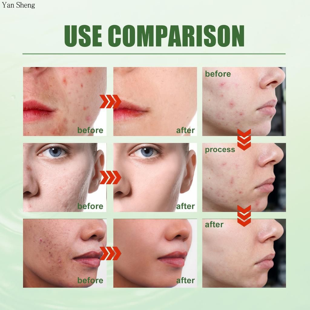 Gesichtsgel Gesichtsreinigung Feuchtigkeitsspendend Reparierend Haut