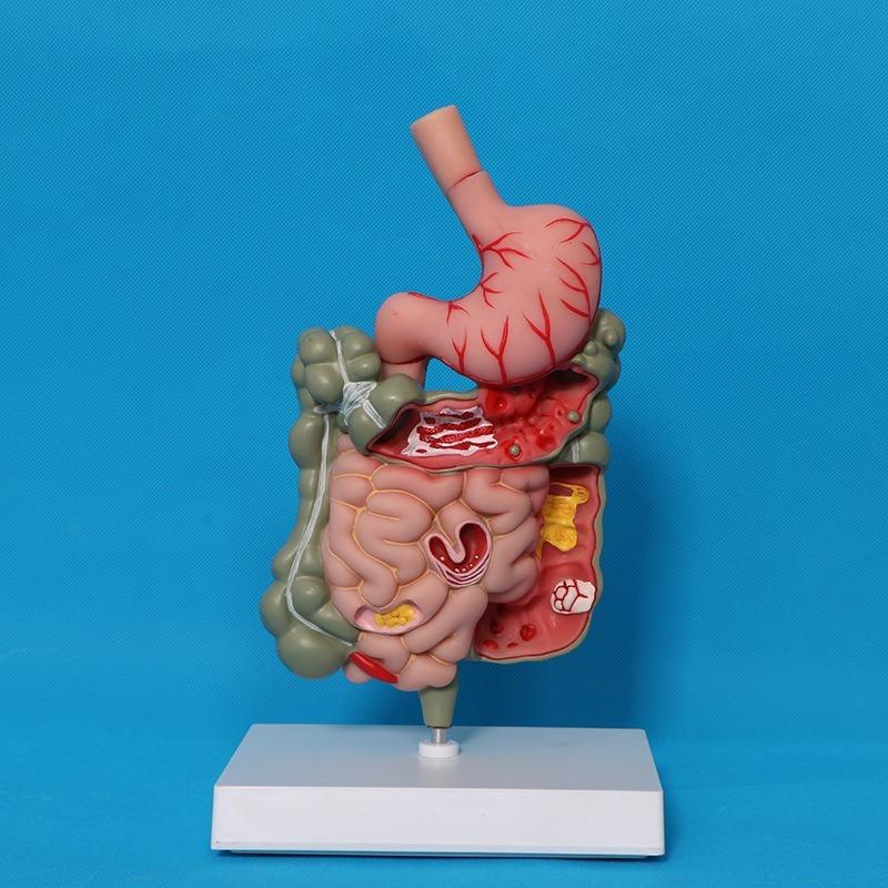 Human Digestive System Model Stomach Anatomy Large Intestine Cecum Rectum Duodenum Human Internal Organs Structure Model