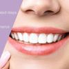 Silicone Simulated Upper and Lower Teeth Braces Soft Dentures Whitening Stickers Smiling Dentures Dental Care Braces