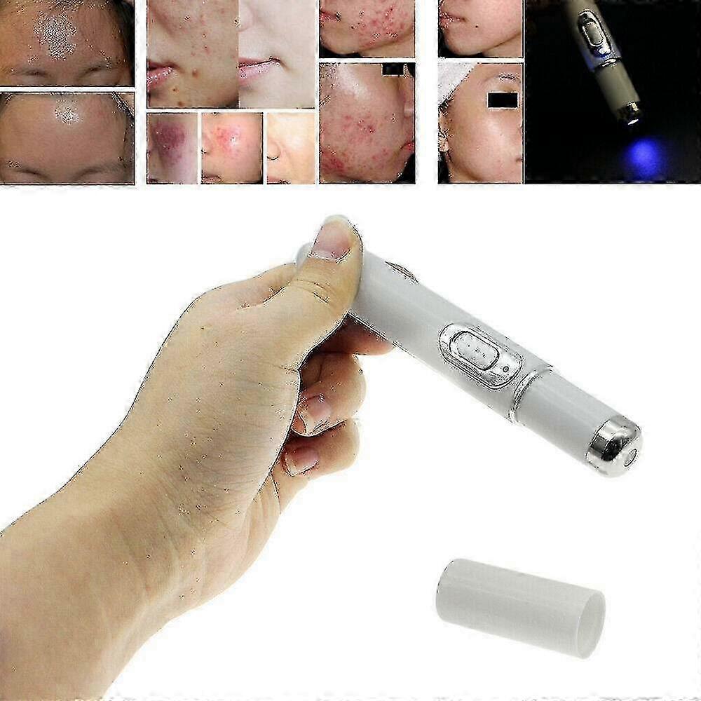 Spider Vein Eraser Blue Light Therapy Wrinkle Acne Laser Pen Soft Scar Removal