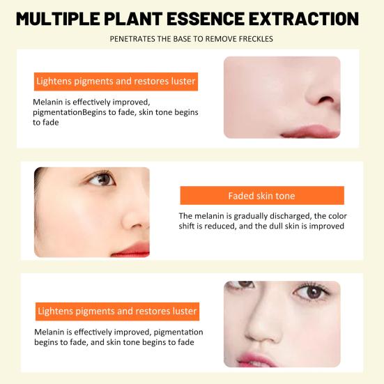 15ml Face Cream Anti-aging Natural Mild Freckle Removal Cream Pen for Ladies