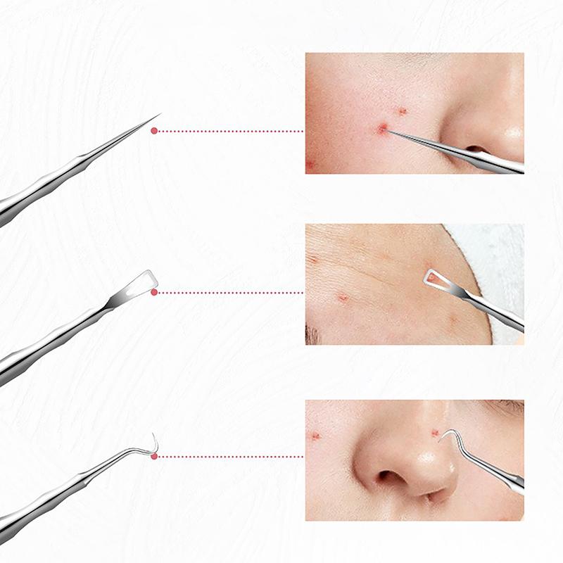 Black Dot Pimple Blackhead Remover Tool Needles For Squeezing Acne Tools Spoon For Face Cleaning Comedone Extractor Pore Cleaner