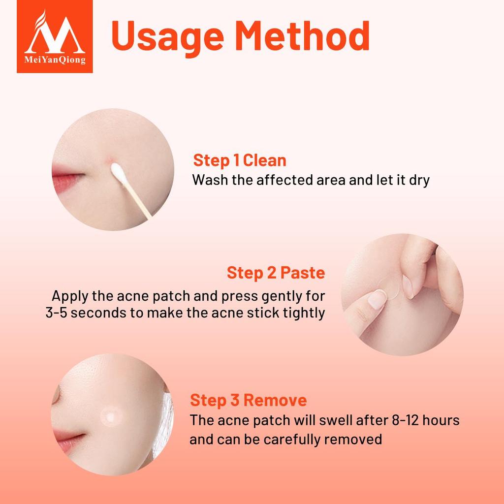 MeiYanQiong Centella Acne Patch Stickers Acne Treatment Pimple Remover Tool Blemish Spot Facial Mask Skin Care Waterproof 24 Patches