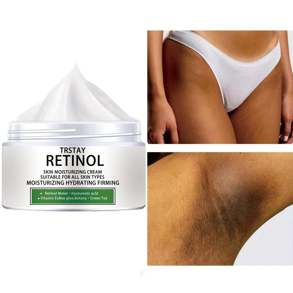 Whitening Cream for Sensitive Areas Dark Skin Lightening Bleaching Cream Legs Knees Whitening Moisturizing Body Lotion Care