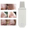 Skin Scrubber Face Spatula Blackhead Remover 4 Modes Deep Cleansing Ultrasound Facial Spatula