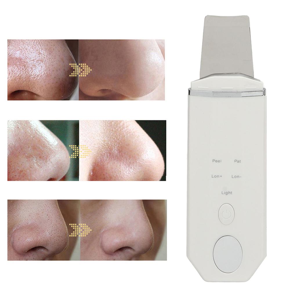Skin Scrubber Face Spatula Blackhead Remover 4 Modes Deep Cleansing Ultrasound Facial Spatula