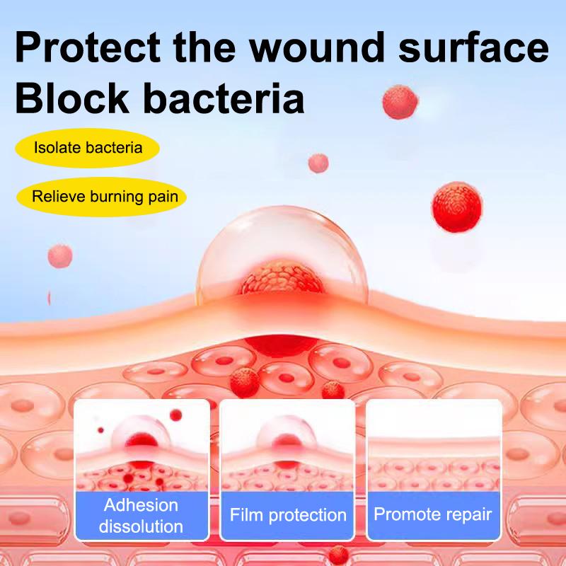 Szybka Pielęgnacja Plaster na Owrzodzenia Jamy Ustnej Opatrunek na Rany Jamy Ustnej Do Aft Szybka Ulga w Bólu Lek na Afty Środek Przeciwbólowy