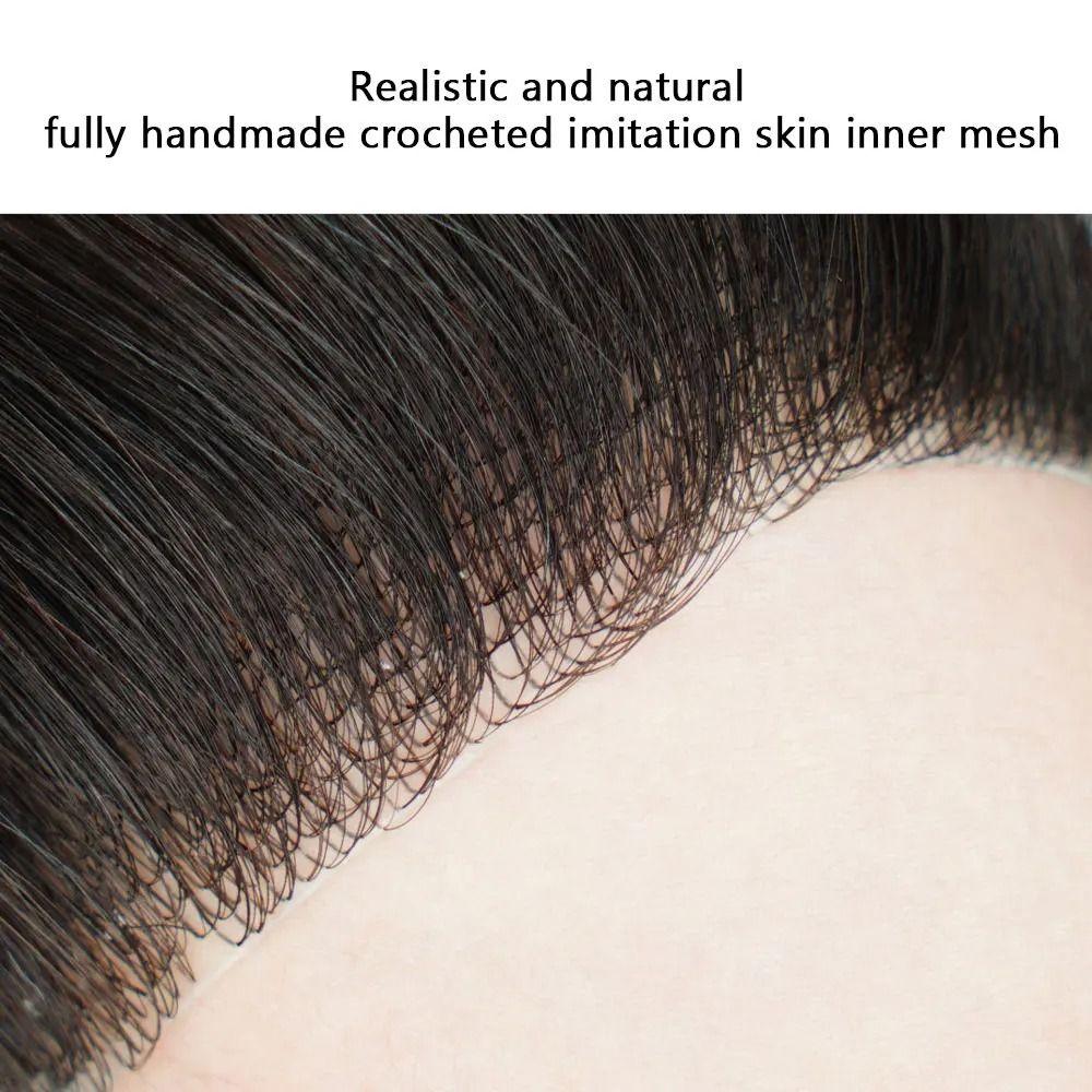 Seamless Natural Human Hair Patch Forehead Biological Scalp Patch  for Baldness Frontline