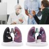 Anatomical Pathological Lung Model Human Lung Anatomy Model Normal and Pathological Lung Anatomy Model for Teaching Tool