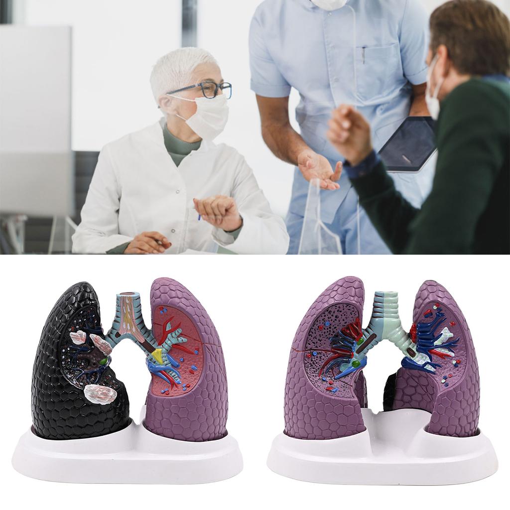 Anatomical Pathological Lung Model Human Lung Anatomy Model Normal and Pathological Lung Anatomy Model for Teaching Tool