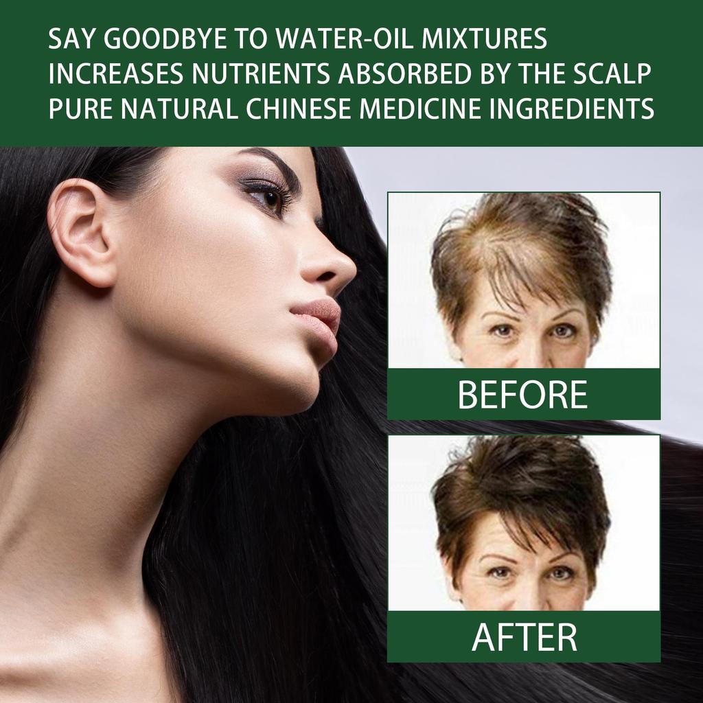 West&Month Ginger Hair Essence 30ml Thickening Hair Growth Serum Strengthens hair, repairs damage, reduces dandruff, improves frizz and dryness