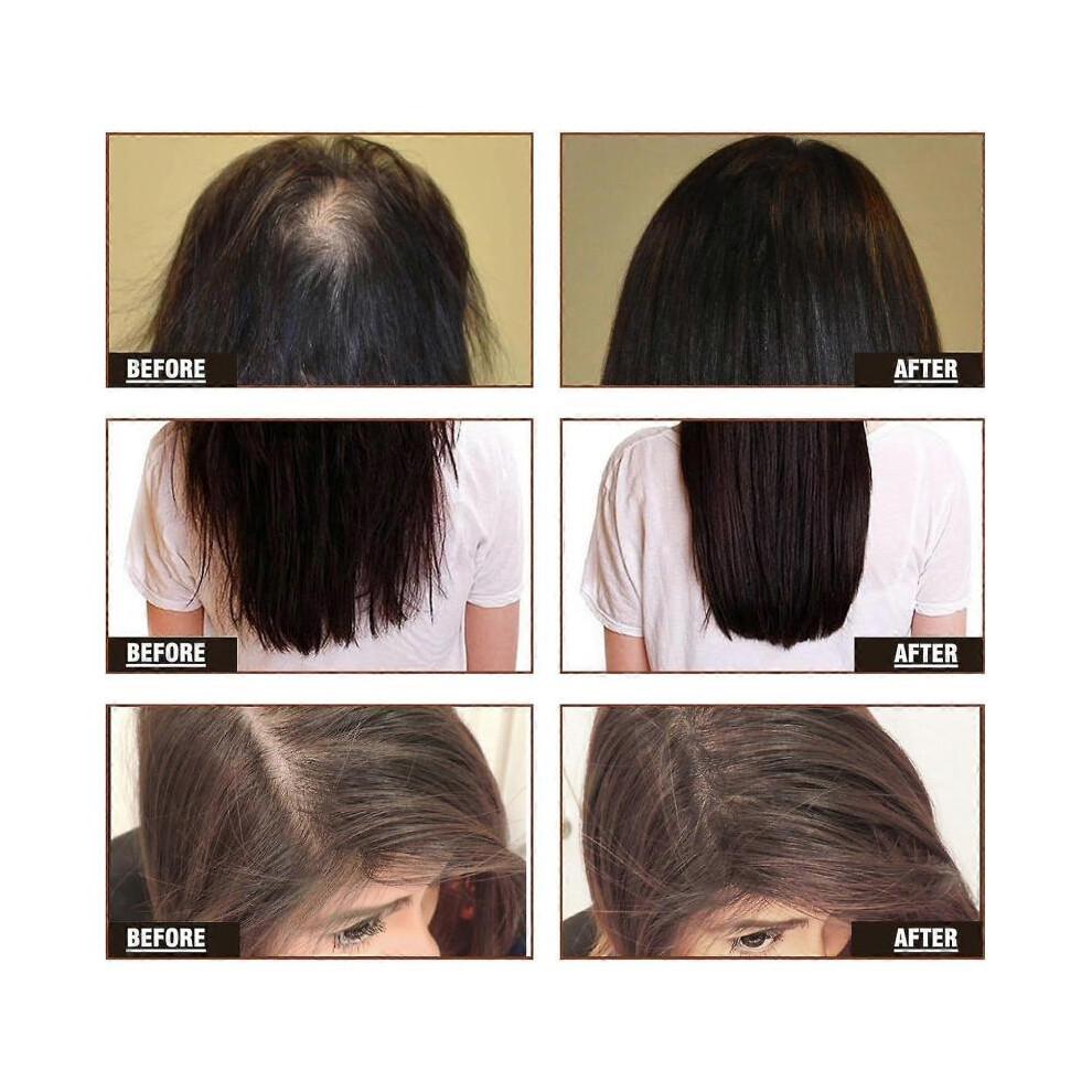 (1pcs) Multi-Peptide Hair Growth Serum for Hair Density, Multi-Peptide Hair Density Serum for Fuller Thicker Hair Regrowth Prevent Hair Loss