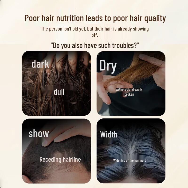 Bawang Shouwu Anti-Hair Loss Shampoo