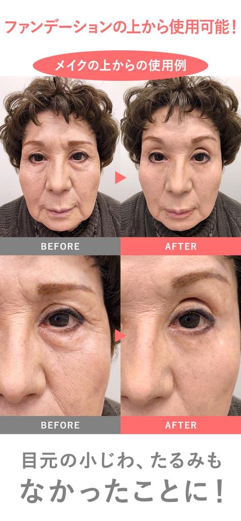 MIRACOCO Link Rule 15g Cream for Face and Eye Corners of the Female (Miracoco) [Official] Eyes, Cream, Forehead, Eyebrows, Eyes, Foundation, Men,