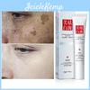 Creme Aufhellen Aufhellen Wirksam Sommersprossen Gesicht Entfernen Dunkle Gesichtsflecken Melasma Anti-Pigmentierung Verbessert Mattheit Hautpflegecreme