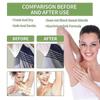 Armpit Refreshing Antiperspirant Spray For Men Women Sweat Odor Deodorant 2025