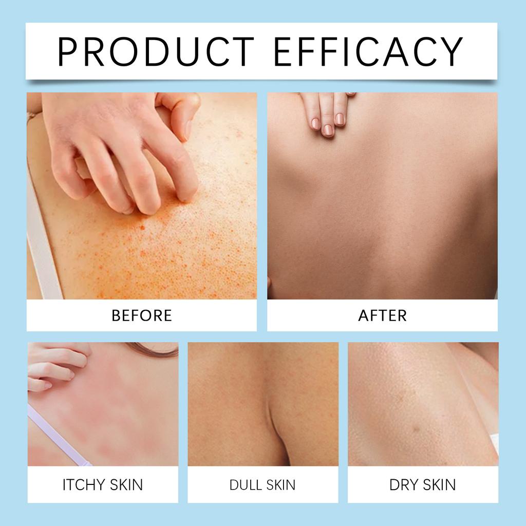 This Skin Care Cream Features Mild Ingredients For Moisturizing And Hydrating. It Is Suitable For Daily External Use And Massage Care.