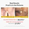 Medicube Kojic Acid Vita Body Peel Shot Large Capacity Body Gommage Peeling Dullness Keratin Summer Measures