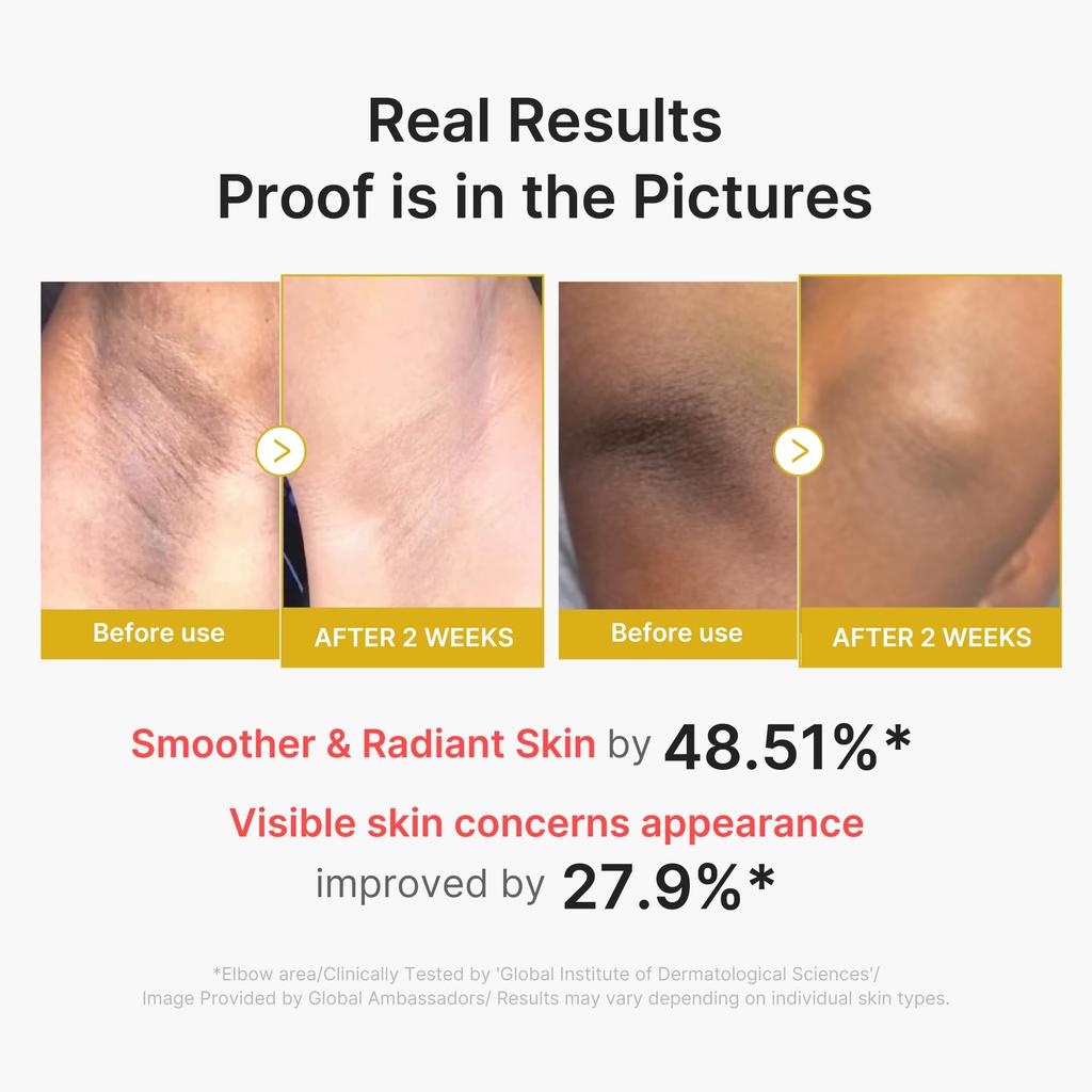 Medicube Kojic Acid Vita Body Peel Shot Large Capacity Body Gommage Peeling Dullness Keratin Summer Measures