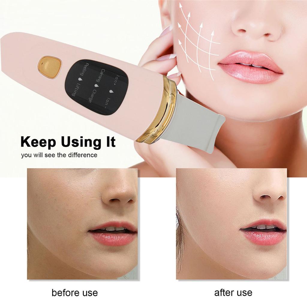 Portable Face Scraper, Blackhead Remover, Skin Spatula, Wireless 4 in 1 Multi Function Facial Lifting,   Cleaning, Nutrient Import, Blackhead Extra