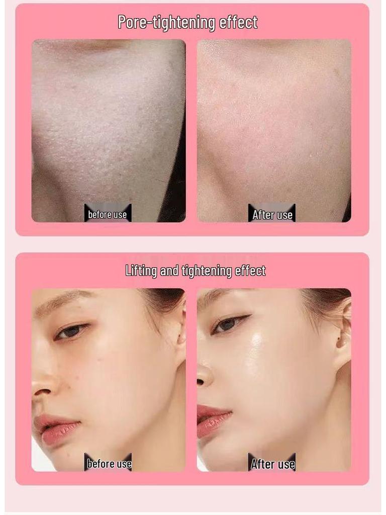 LED Beauty Device: Face Mask Lifting, Firming, and Rejuvenation with EMS & RF Technology