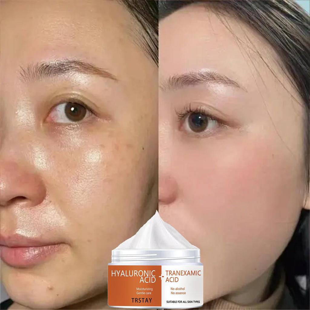 Scar removing and whitening essence cream protects the damaged skin on the face, brightens skin tone, anti-aging nourishing moisturizer