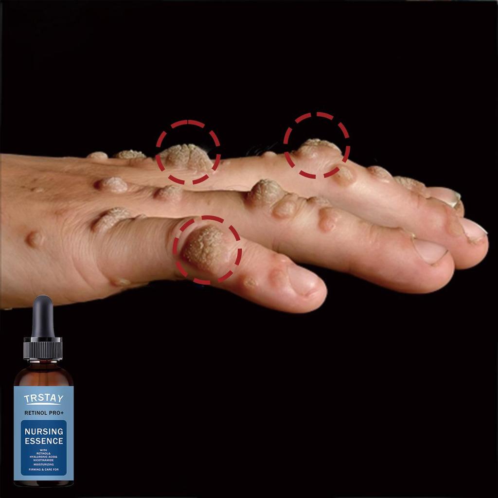 Water Replenishing and Moisturizing Essence Liquid, Fresh and Non Greasy, Nourishes Skin, Alcohol Free and Non Irritating