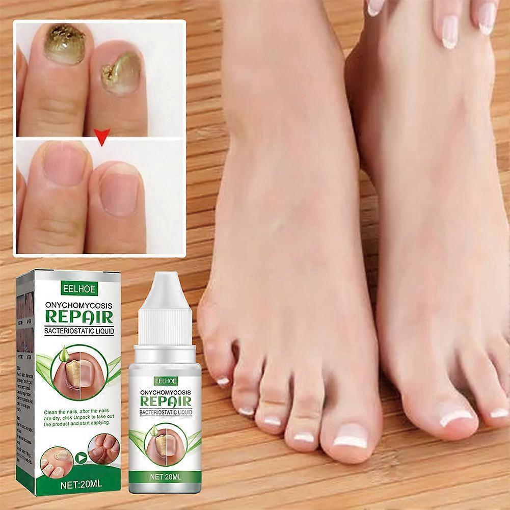 2X 2024 New Tea Tree Essential Oil Nail Fungus Repair Liquid, Treatment for Thickening, Discoloration, Softening, Onychomycosis Care, 20ml