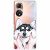 Clear Soft TPU Cover For Honor 50 Pro Lite Case Honor70 5G New Silicone Transparent Funda for Huawei Honor 70 5G Honor50 Coque