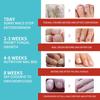 16pcs/box Foot Nail Repair Patch Grey Fungal Nail Thicken Soft Paronychia Infection Hand Nail Correction Sticker Ingrown Toenail