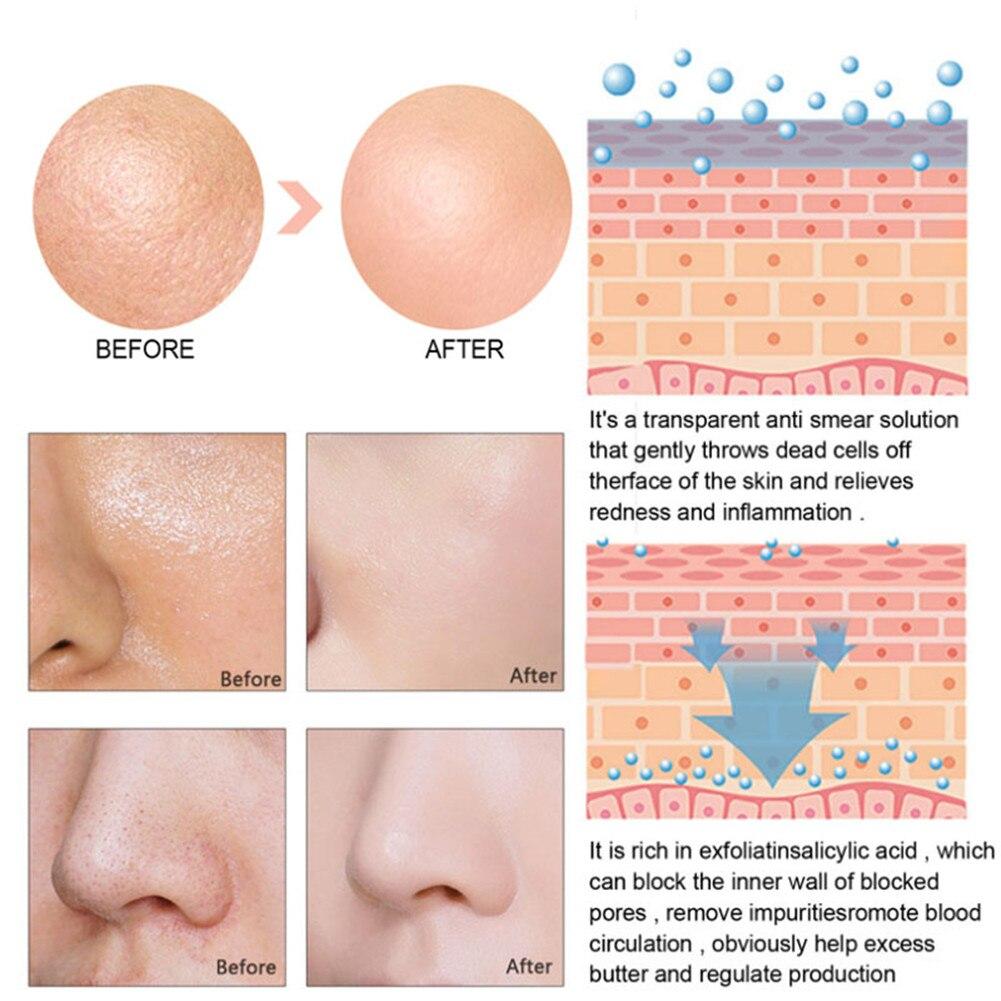 Face Serum Moisturizing Shrink Pore Brightening Firming Facial Skin Care Essence Deep Moisturizing Niacinamide XYZ