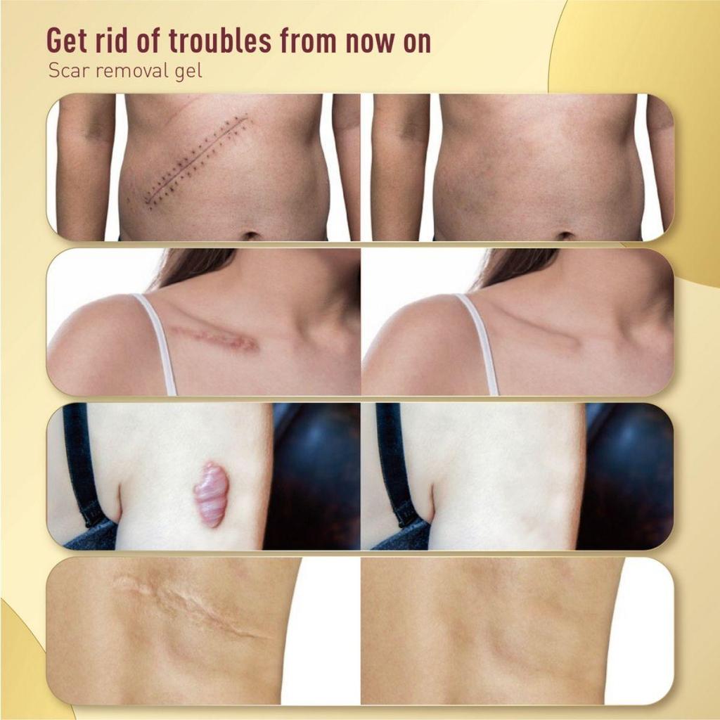 Creams, Skin Wounds, Creams, Burns, Fading Creams, Surgical Repairs, Skin Care, Skin Whitening Creams