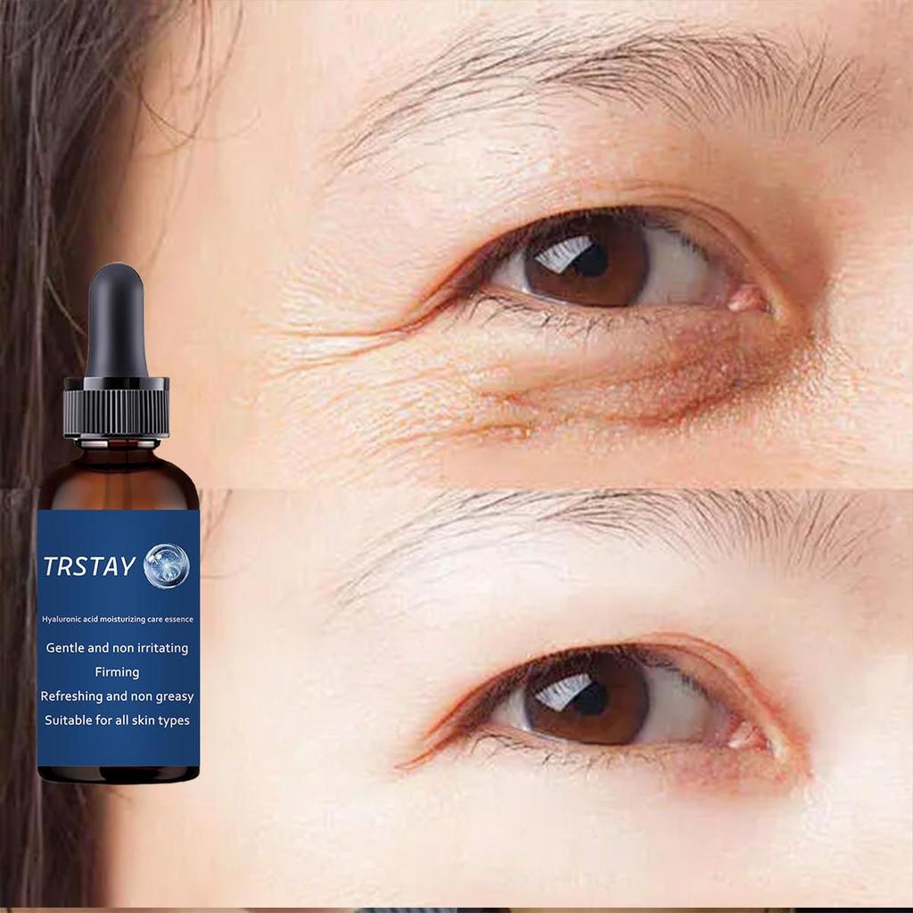 TRSTAY Intensiv øyekrem for rynkereduksjon og dyp fuktighetstilførsel