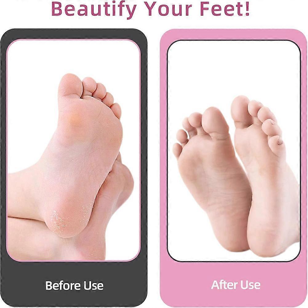Electric Foot Callus Remover, Professional Callus Remover for Feet with 60pcs Sandpaper Discs Pink