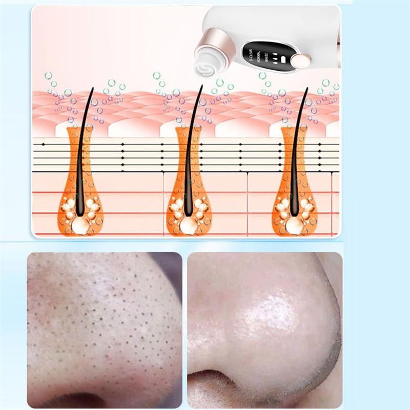 New Facial Cleanser  Nose Acne Remover  Face Pore Cleansing Tool  Powerful Adsorption Exfoliation  Deep Cleansing Beauty Tools