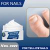 Nail Care Cream, Safe and Gentle for Repairing Nails On Hands, Feet, and Toes, Removing Nail Fungi, Repairing and Caring for Paronychia
